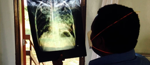 RID-TB: Reducing the Impact of Drug-Resistant TB in Western Province, Papua New Guinea