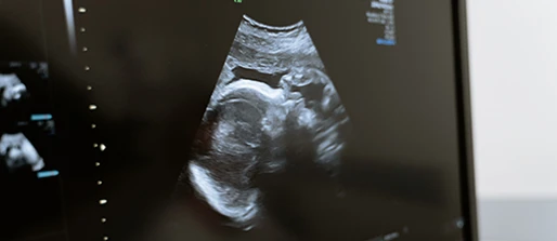 Target product profile for obstetric ultrasound devices