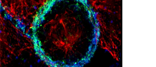 Fc receptor targeted treatments in inflammation and allergy