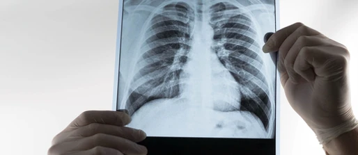 Optima Tuberculosis modelling